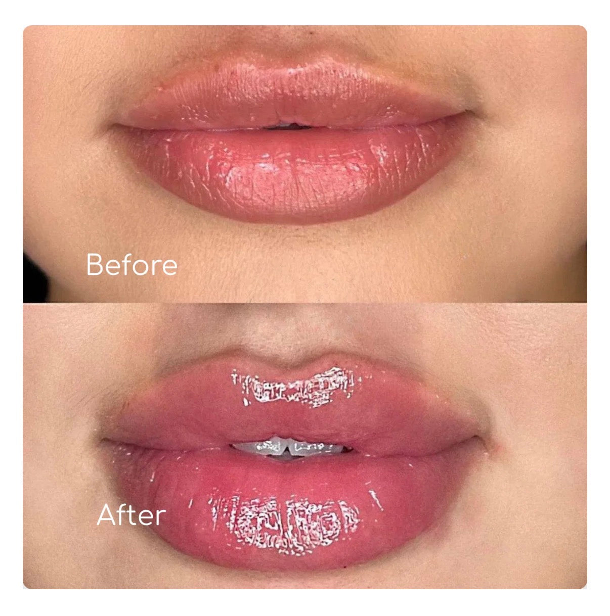 Tuicy J | Maximum Lip Plumper (2ml)